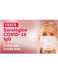 SARS COV-2, ANTICORPOS IgG